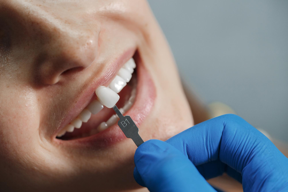 A woman smiles as a provider installs veneers in Craven County