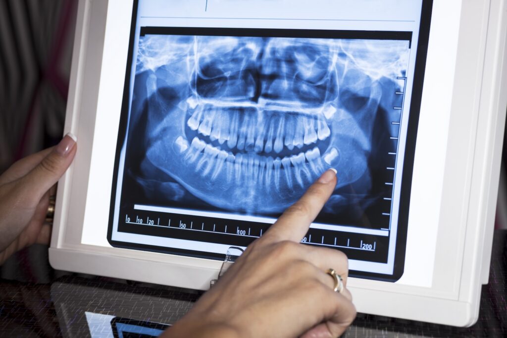 A forensic dentist in Craven County examines x-rays after an accident.
