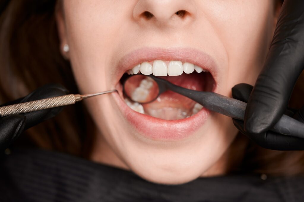 A forensic dentist in New Bern examines a person's teeth to compare it with evidence.