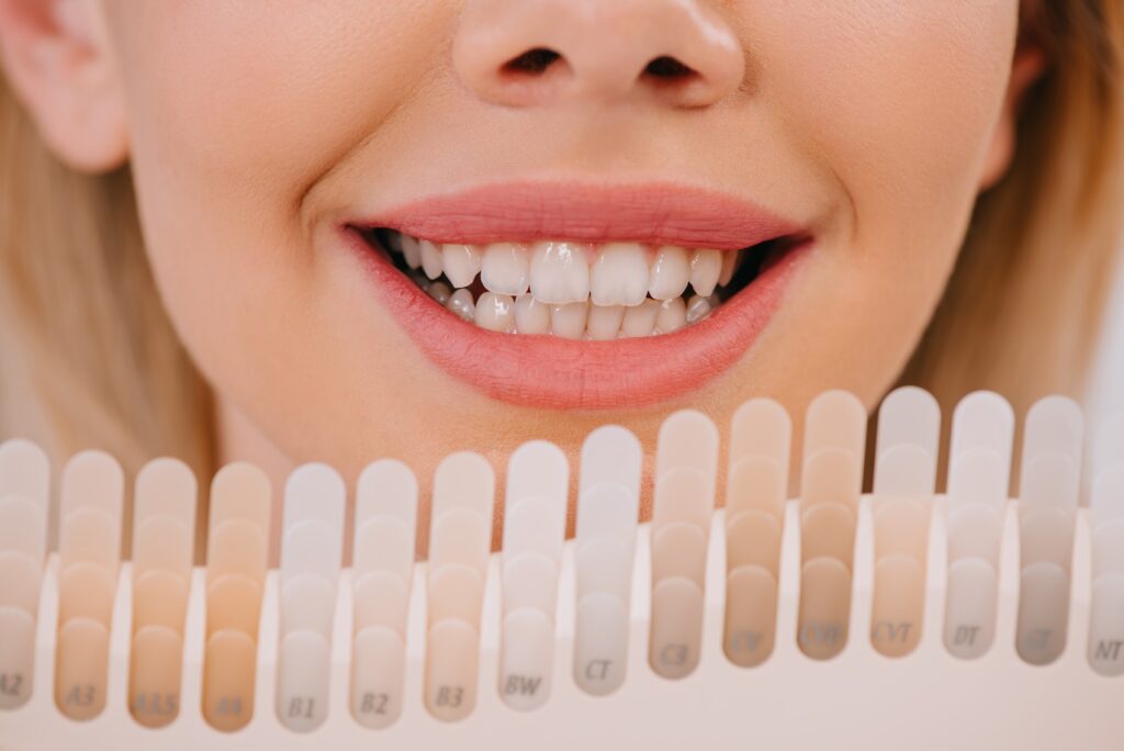 A woman compares different shades of teeth whitening in Craven County.
